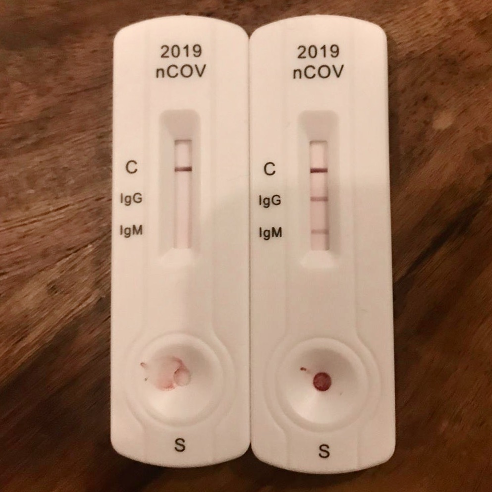 Testing For Coronavirus 2 Things You Absolutely Need To Know About How   IgGIgM Covid19 Test 